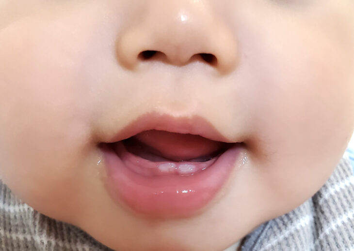 離乳食は歯の本数で決まる？月齢別にわかる正しい進め方と注意点